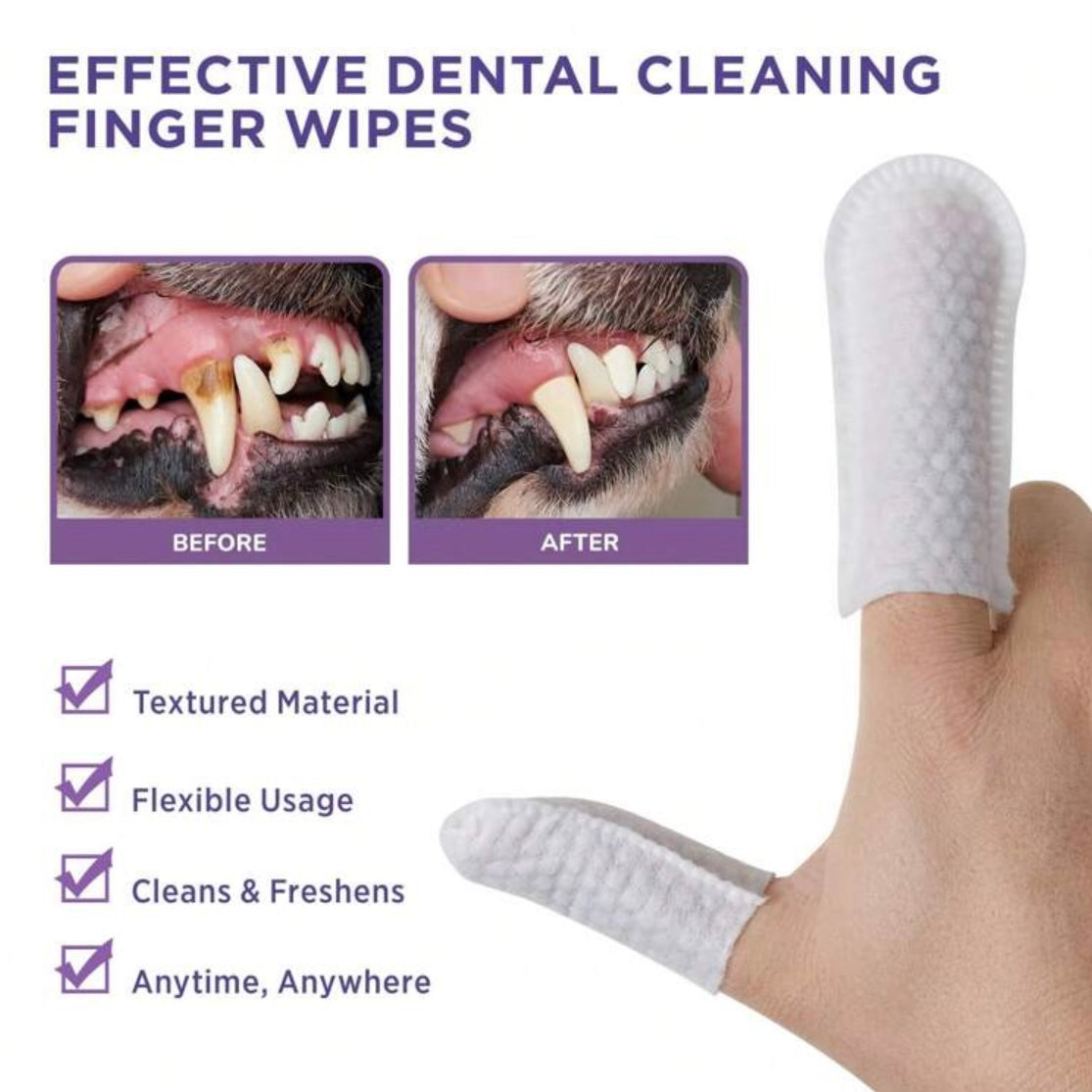 Dental Care Wipes
